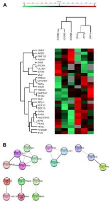 Red blood cell proteomics reveal remnant protein biosynthesis and folding pathways in PIEZO1-related hereditary xerocytosis